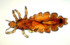 Pediculus humanus capitis